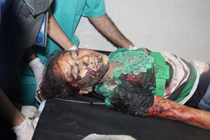 صور: مجزرة الشجاعية.. أكثر من 60 شهيداً ومئات الجرحى نتيجة القصف العشوائي