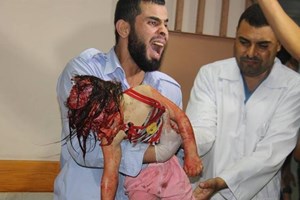 محدث: 436 شهيداً وأكثر من 3 آلاف جريحاً حصيلة العدوان في يومه الأكثر دموية