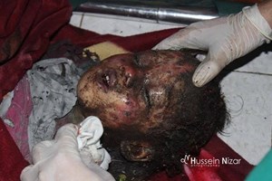 بالصور...مجازر رفح ترفع حصيلة شهداء العدوان لأكثر من 1844 شهيدا