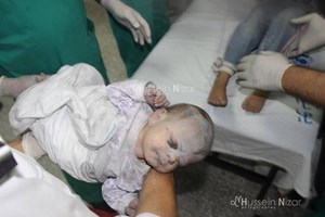 Israel bombs Gaza ambulance as Friday death toll surpasses 100