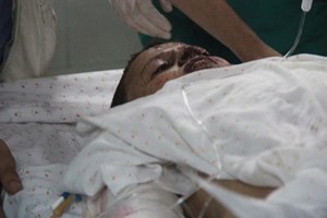 2137 شهيداً و أكثر من 11100 جريحاً حصيلة اليوم 51 من العدوان  