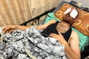 الفدائي "المبحوح".. يواجه خطر فقدان بصره بانفجار جسم من مخلفات الاحتلال